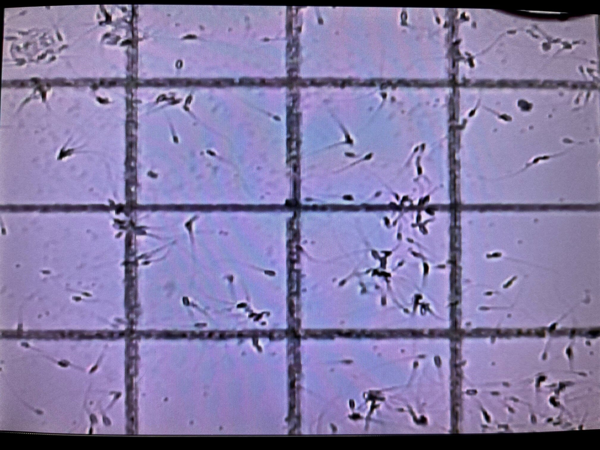 Cell-Vu Disposable Sperm Counting Chamber DRM-600 (50ct) - Image 7