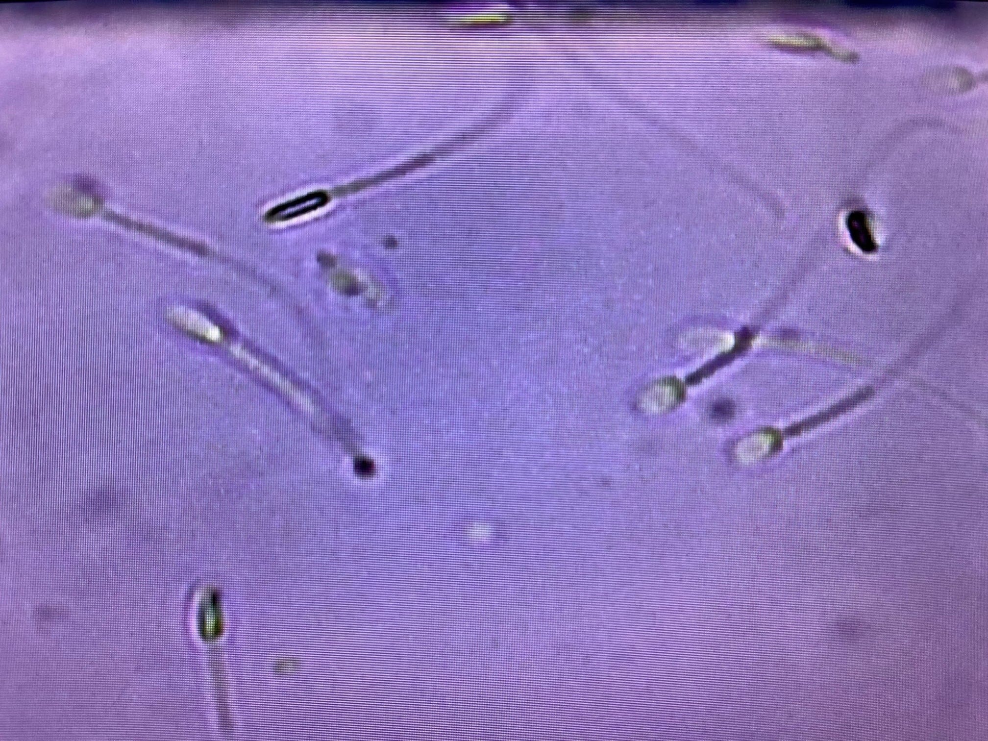 Cell-Vu Disposable Sperm Counting Chamber DRM-600 (50ct) - Image 8