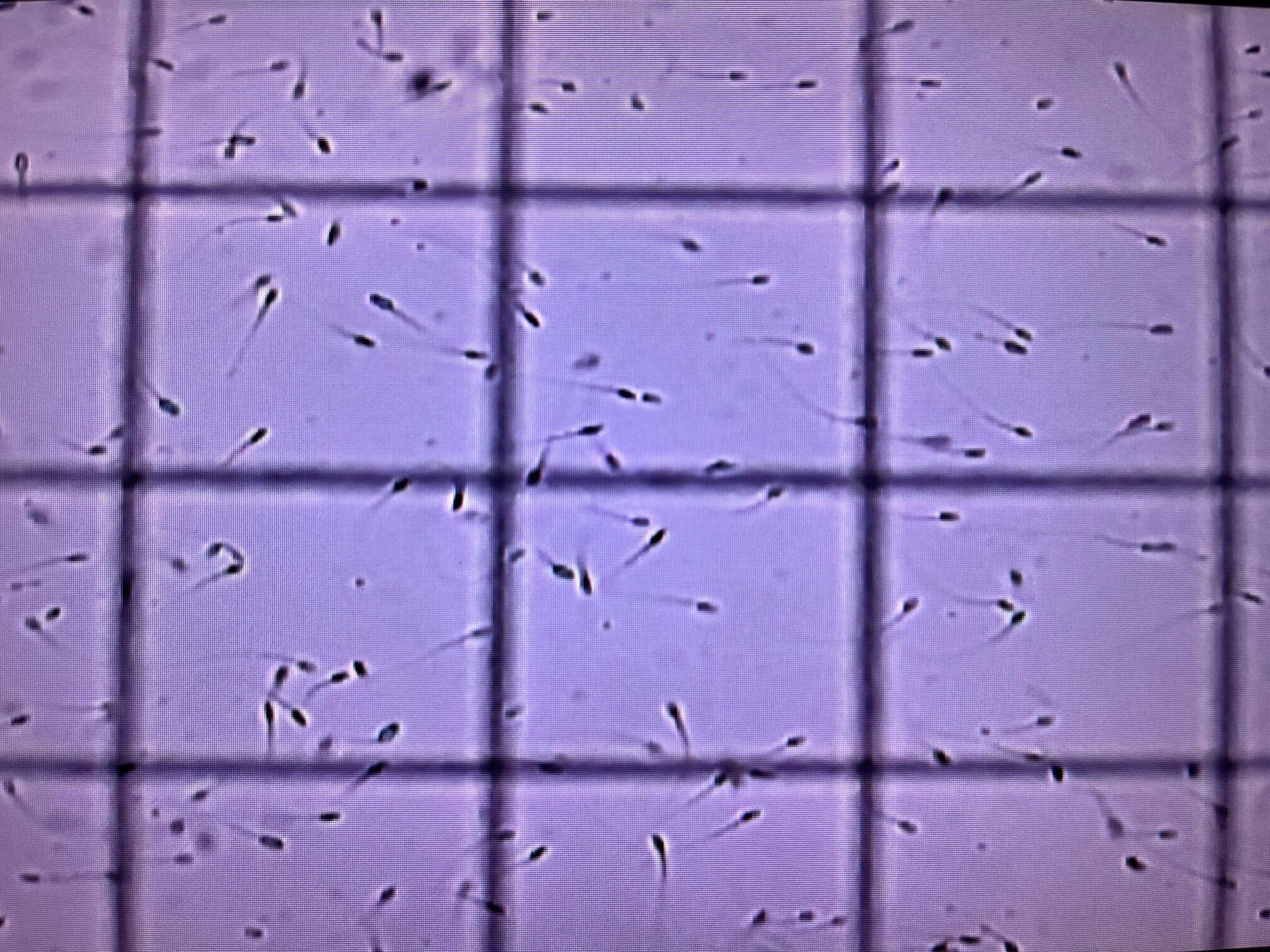 Cell-Vu Disposable Sperm Counting Chamber DRM-600 (50ct) - Image 9